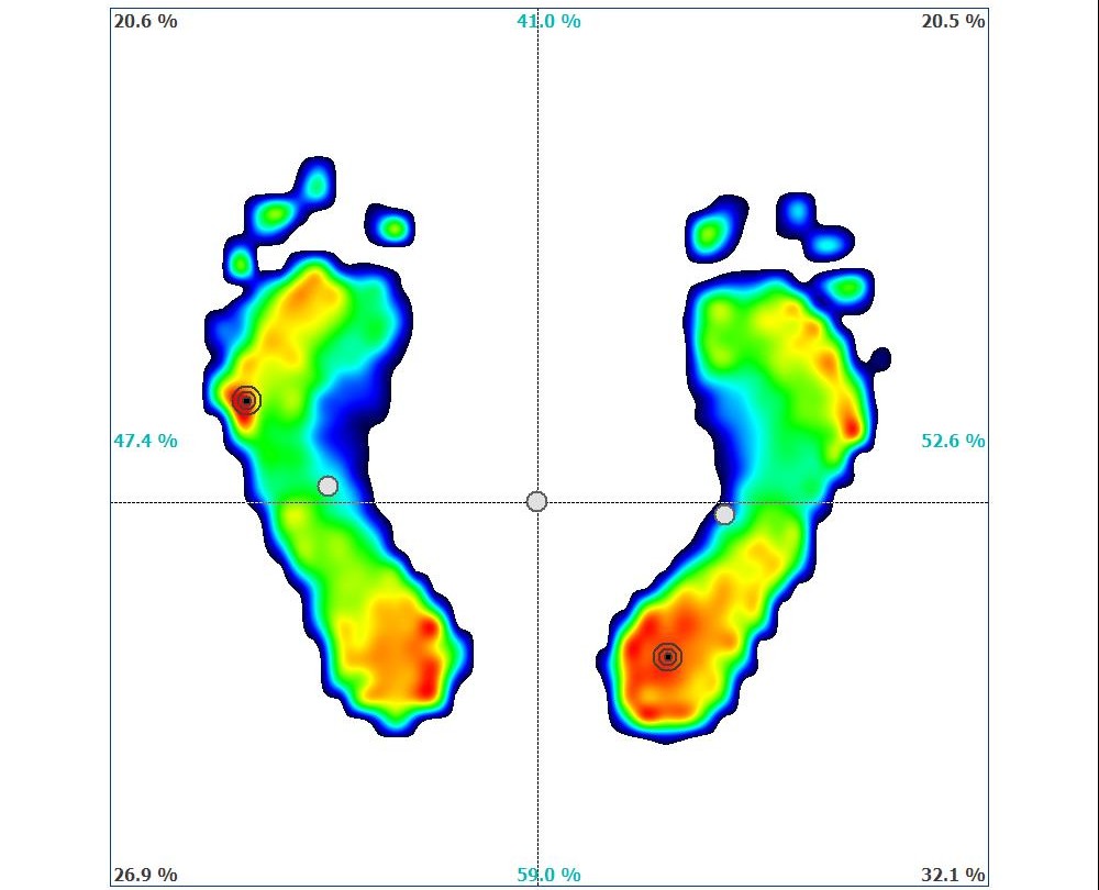 Área de fisioterapia